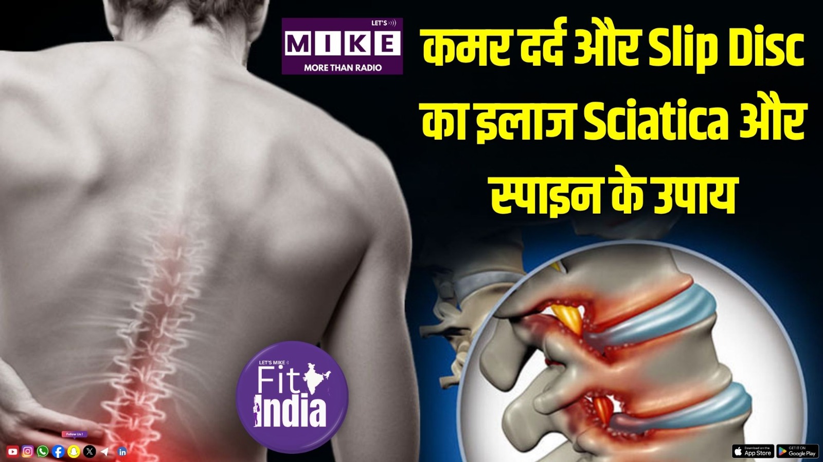 कमर दर्द और Slip Disc का इलाज | Sciatica और स्पाइन के उपाय | Fit India
